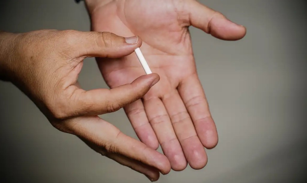 Anvisa atualiza regras sobre implantes hormonais “Chips da&nbsp;Beleza”