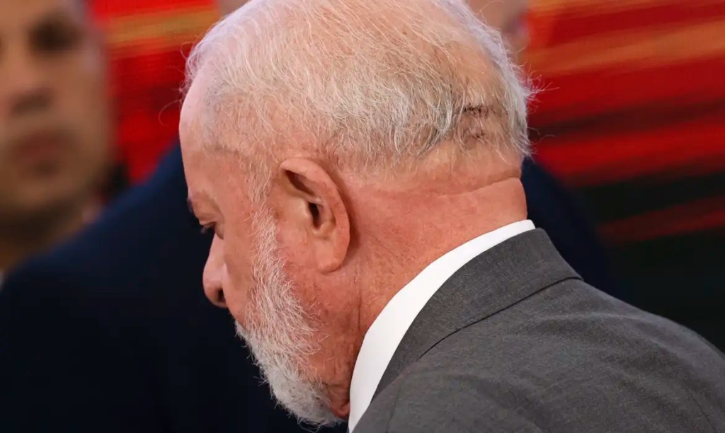 Lula tem dreno retirado e segue lúcido e bem, diz boletim&nbsp;médico