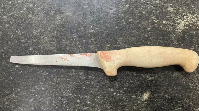 Mulher é presa suspeita de matar companheiro a facadas após discussão e&nbsp;agressão